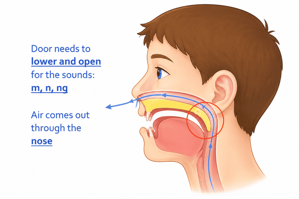 side view of cleft palate